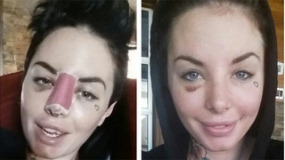 Christy Mack Posts Recovery Photos, Is Called a Dick-Sucking Whore